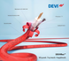 Нагревательный двухжильный кабель DEVI FLEX 18Т - 34м / 4,2м² / 615Вт (140F1240)